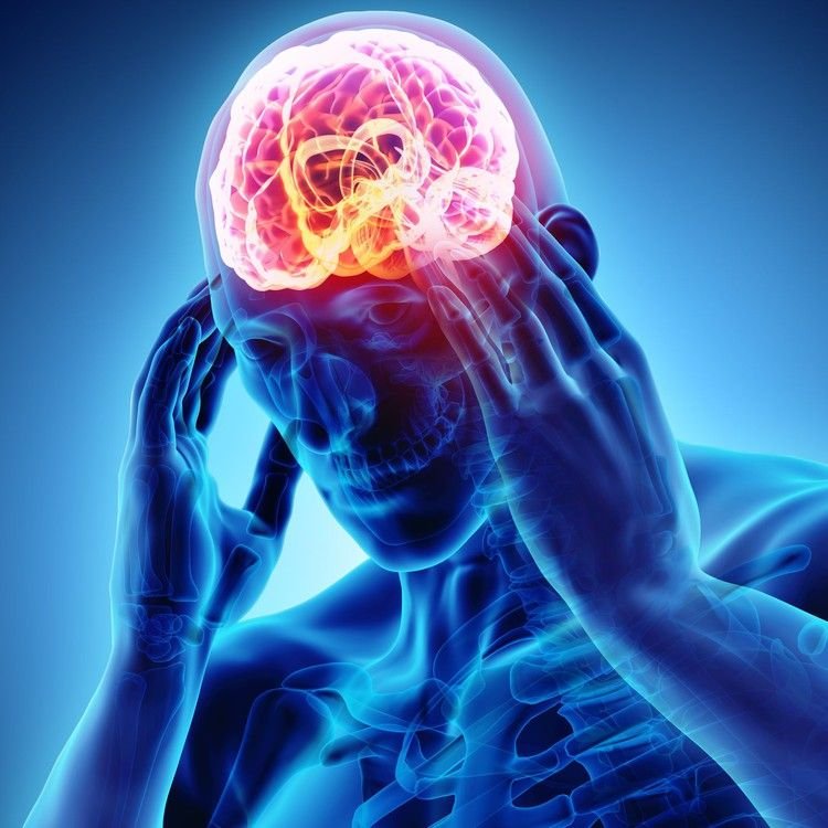 Migraine & Headache Relief