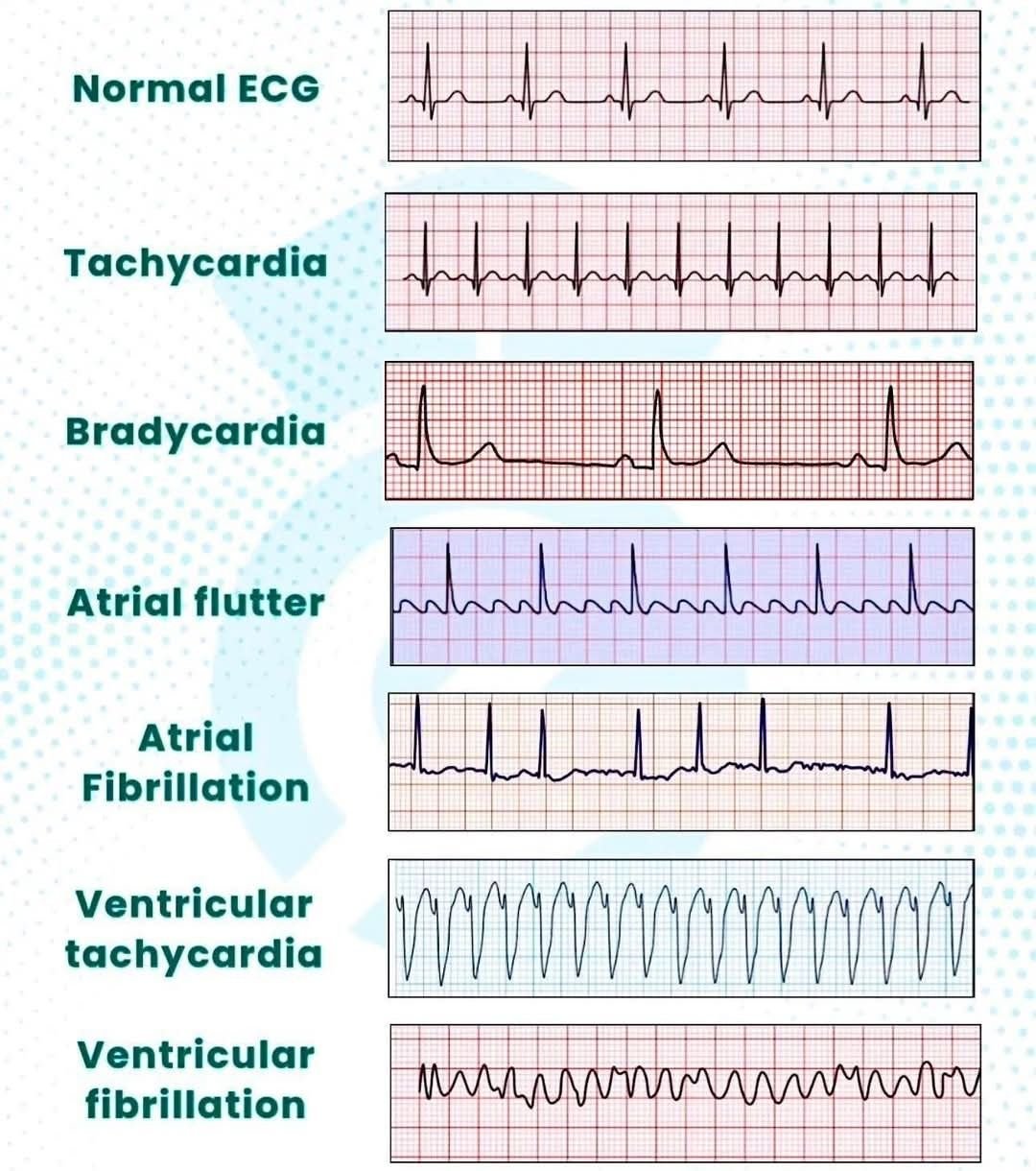 • ECG & Basic Diagnostics
