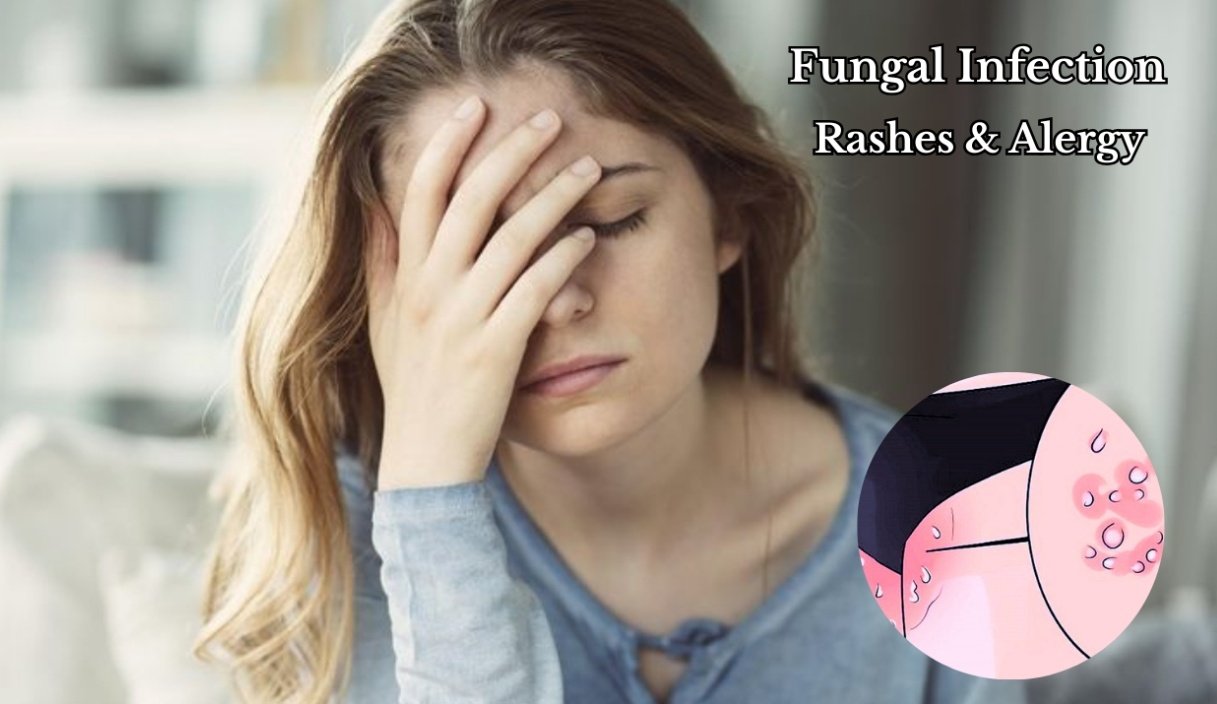 Fungal infections ruining comfort? Constant itching during periods?