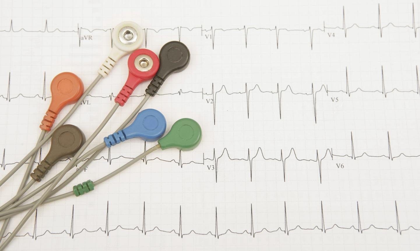 Heart Health & Cardiac Screening