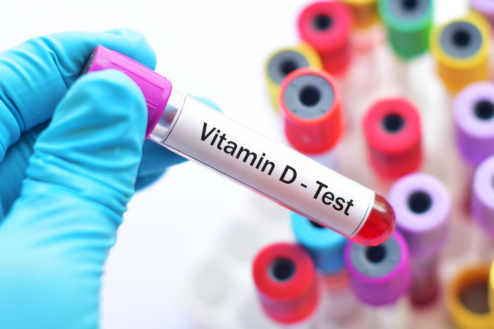 Vitamin & Nutrition Testing