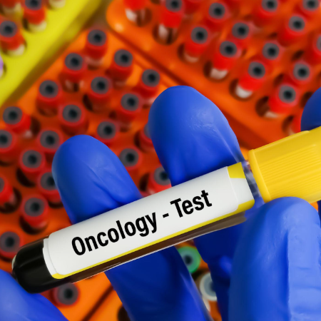 Cancer Marker Screening