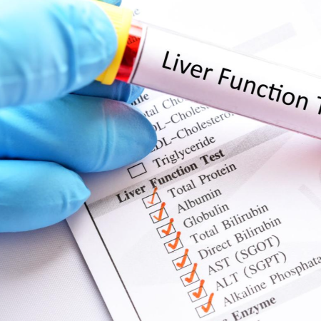 Liver Function Tests & Kidney Function Tests