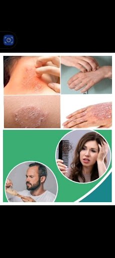 Skin Allergy & Psoriasis Treatment