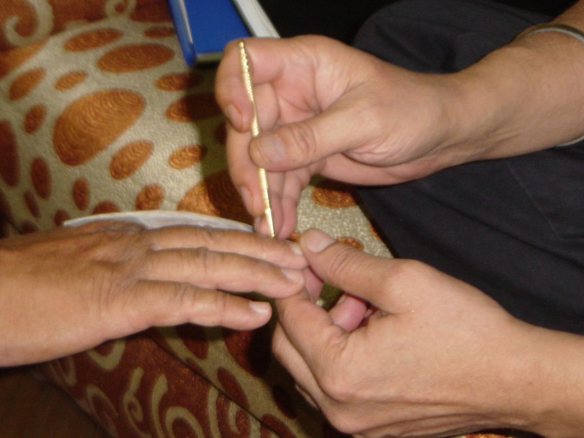Sujok Therapy –