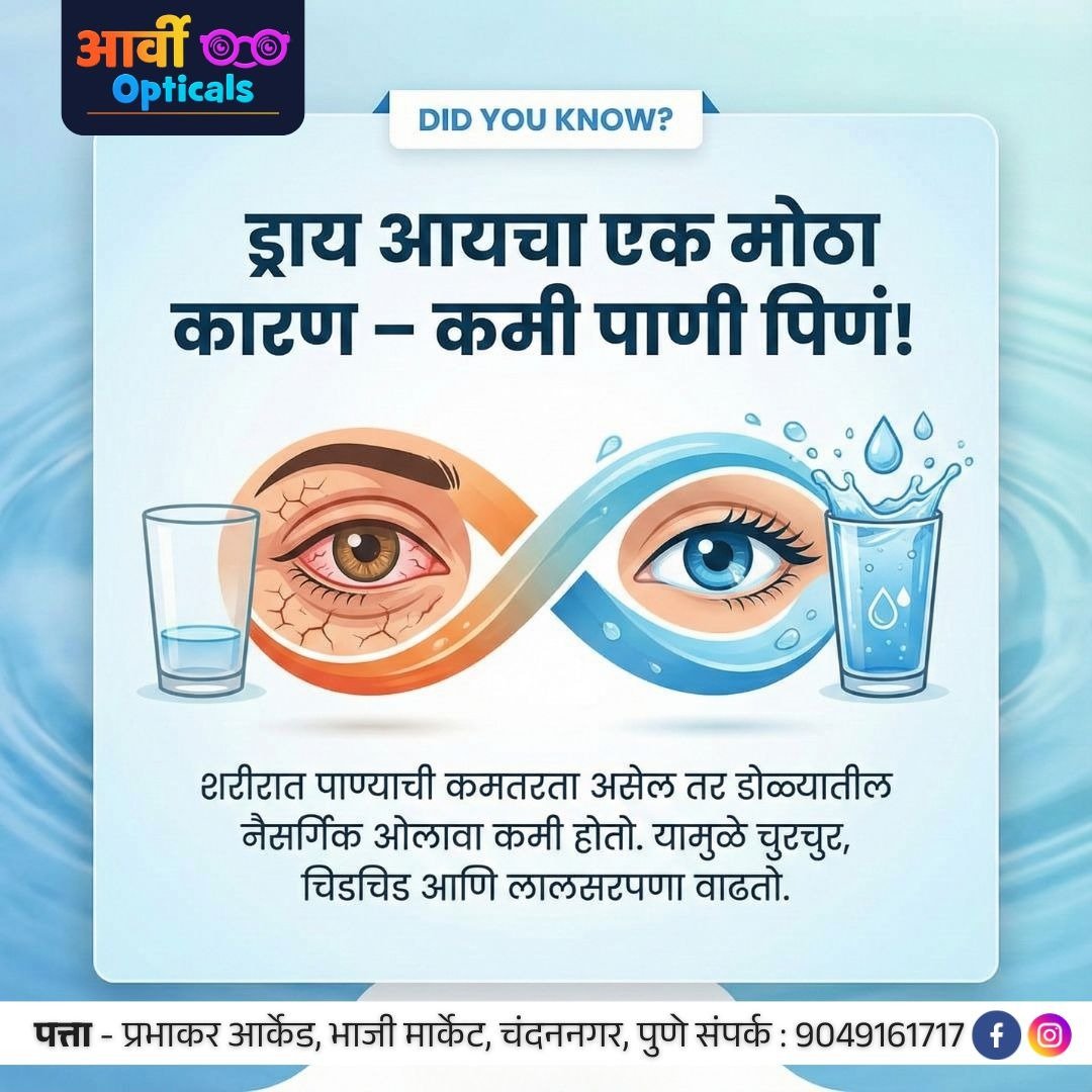 Dry Eye Check-Up & Eye Care Consultation