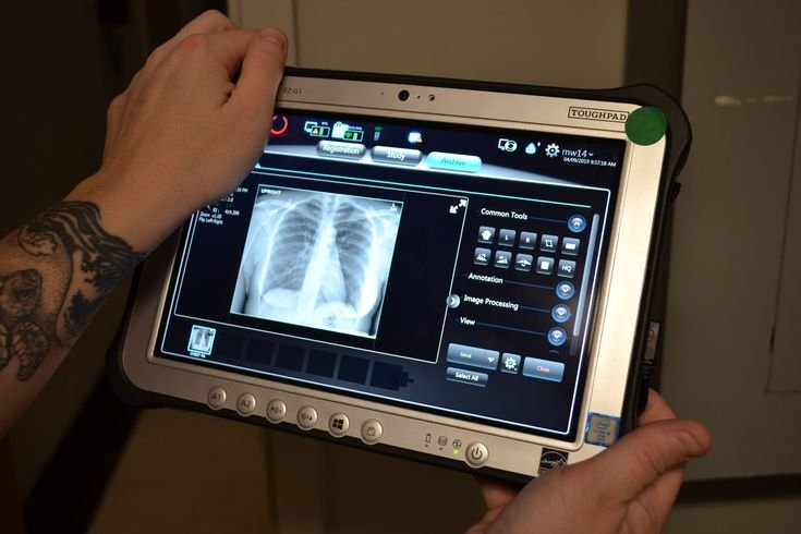 Portable X-Ray at Home