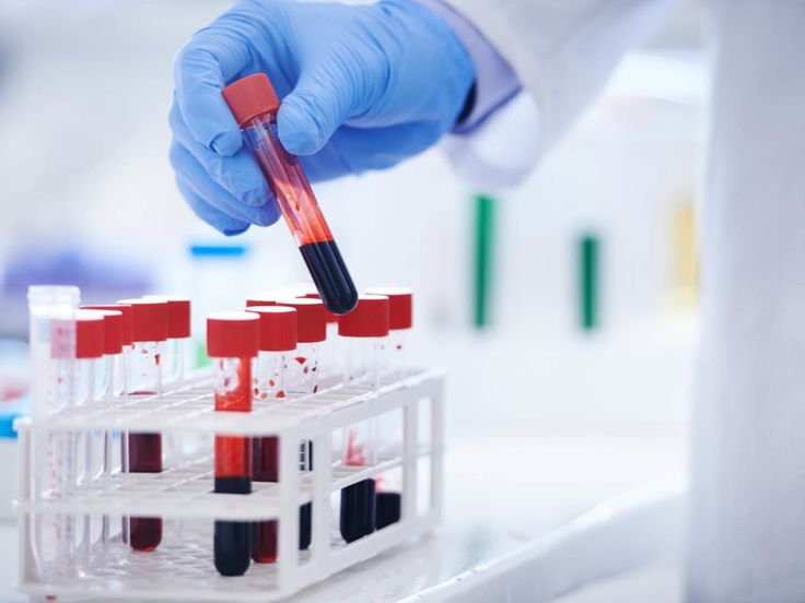 Blood Testing
