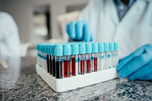 LFT (Liver Function Test)