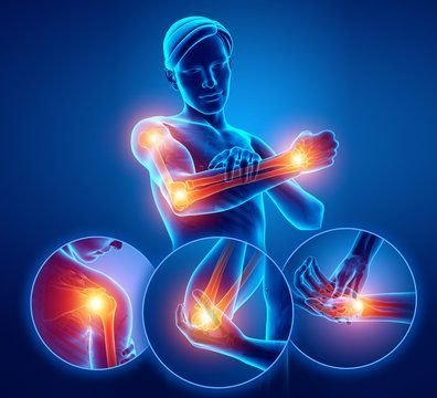 Joint Pain & Arthritis Relief