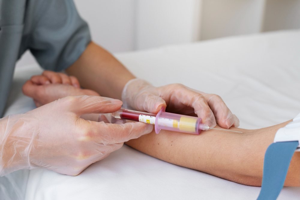 Blood Test
