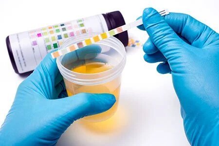 Urine Test