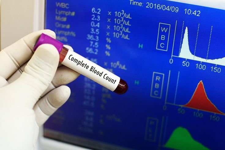 Complete Blood Count (CBC)