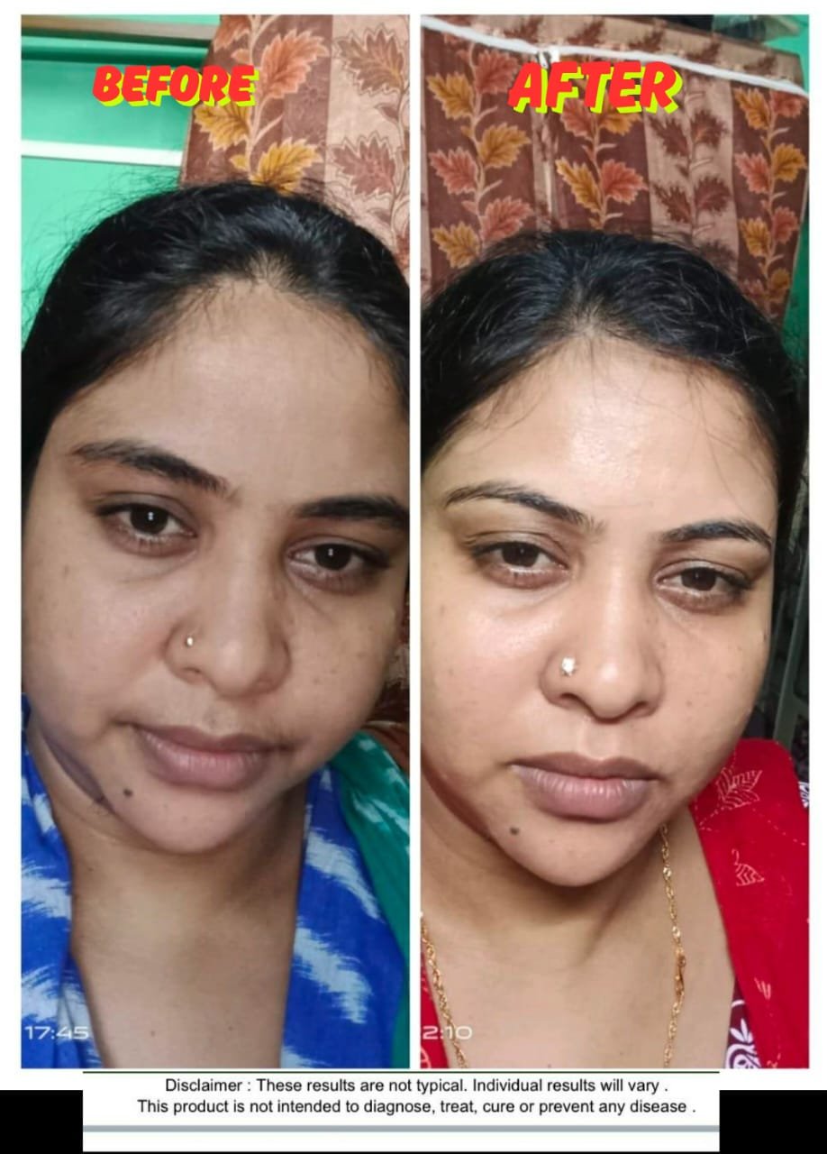 Skin Solution