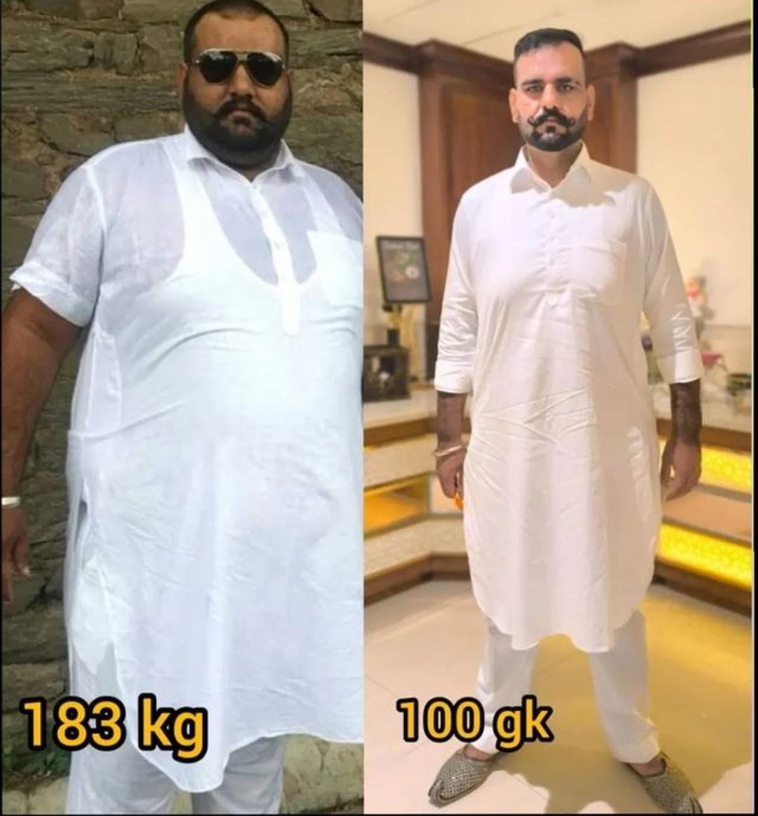 Weight Loss Programs