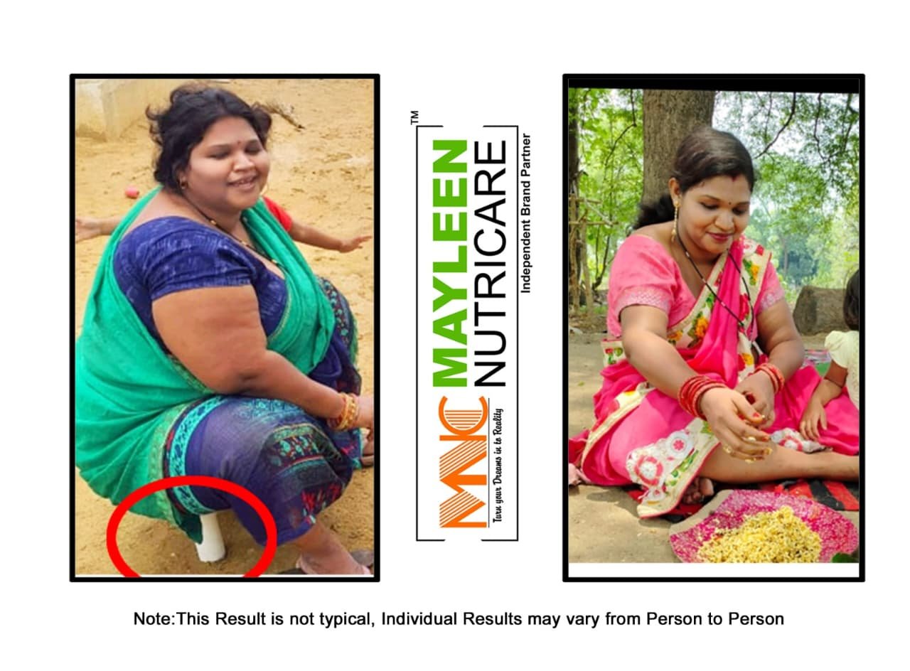 Weight Loss Programs