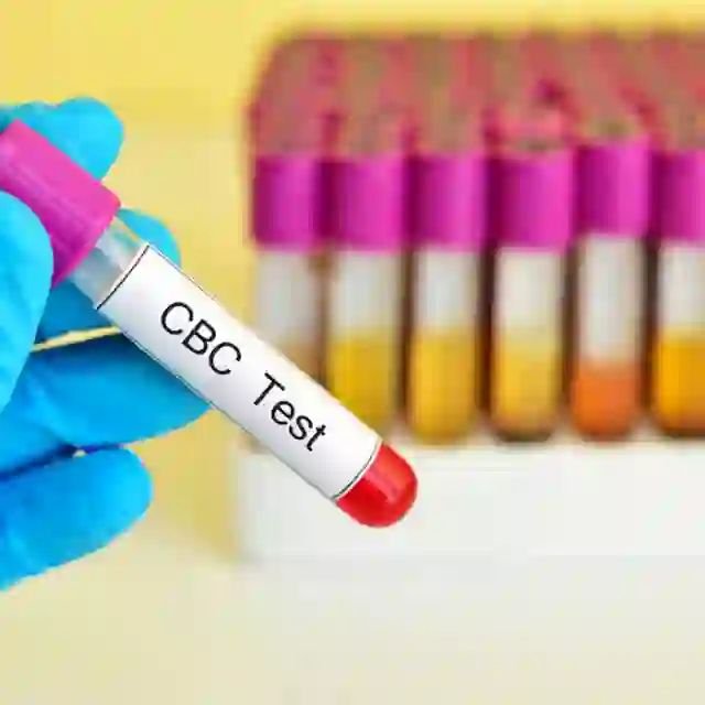 Complete Blood Count (CBC)