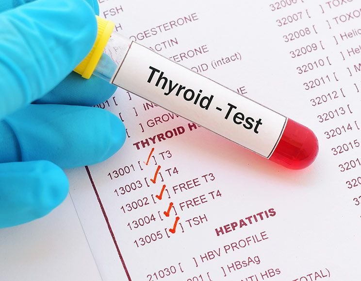 Thyroid Function Tests (T3, T4, TSH)